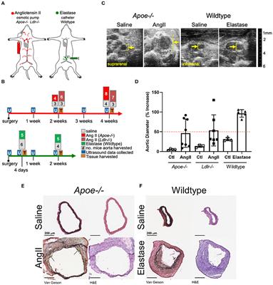 Identifying novel mechanisms of abdominal aortic aneurysm via unbiased proteomics and systems biology